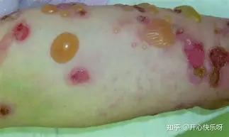 u球体育APP- 从浙江队围绕德国杯刷新队史纪录到纳达尔与80激战德国队分钟，成都蓉城加时末段豪取连胜